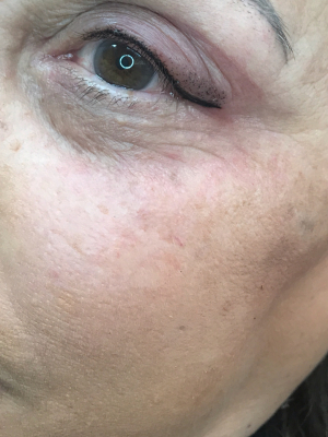 Permanent makeup eyes top by Oksana Lo at Face and Body Definition in New York, NY 10001 on Frizo